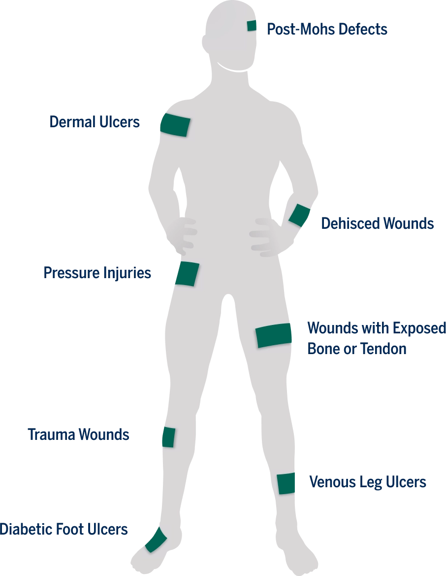 AmchoThick usage areas