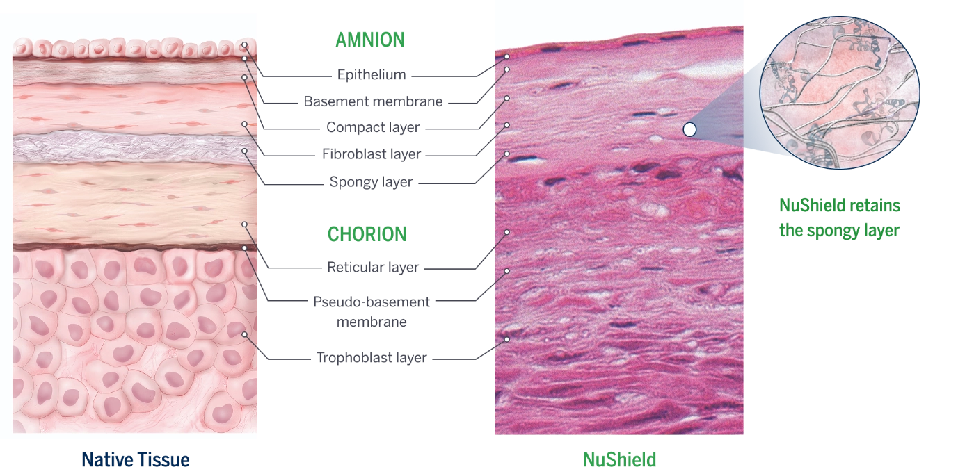 Native tissue vs NuShield histology